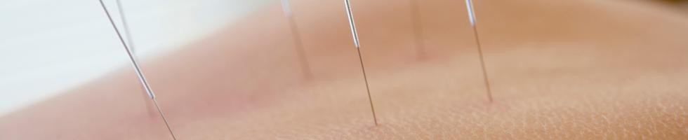 Få smertelindrende akupunktur i Herning