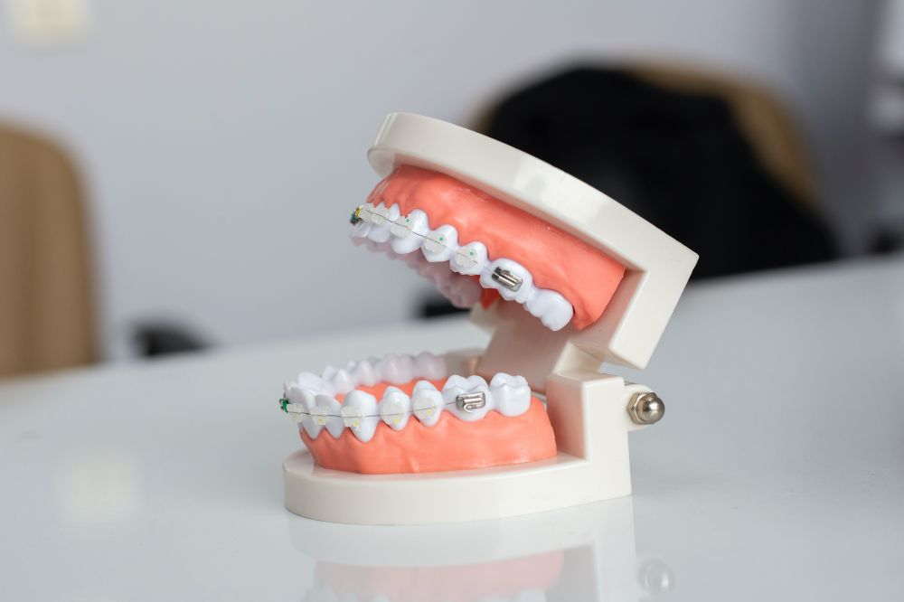 Faren ved skæve tænder: Hvorfor du bør få dem ordnet